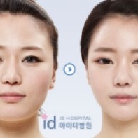 Korean plastic surgery